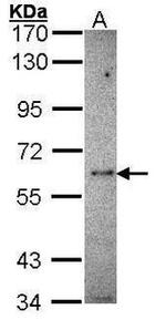 MMP14 Antibody in Western Blot (WB)