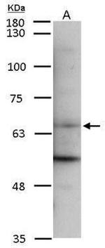 MMP14 Antibody in Western Blot (WB)