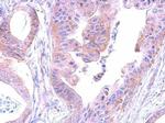 SHC Antibody in Immunohistochemistry (Paraffin) (IHC (P))