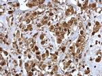 JAK2 Antibody in Immunohistochemistry (Paraffin) (IHC (P))