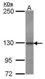 JAK2 Antibody in Western Blot (WB)