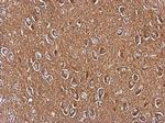 Axl Polyclonal Antibody