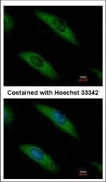 Aldolase B Polyclonal Antibody