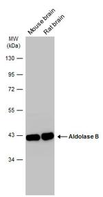 Aldolase B Antibody in Western Blot (WB)