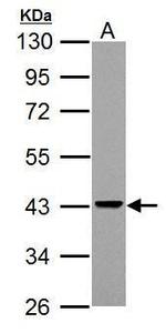 Adenosine Deaminase Polyclonal Antibody