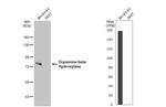 Dopamine beta Hydroxylase Antibody in Western Blot (WB)