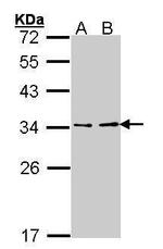 V-ATPase E1 Polyclonal Antibody