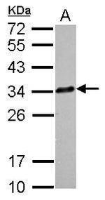Clathrin Light Chain A Polyclonal Antibody