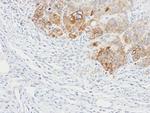 BAP31 Antibody in Immunohistochemistry (Paraffin) (IHC (P))