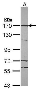 53BP2 Polyclonal Antibody
