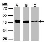 ACAT1 Antibody in Western Blot (WB)