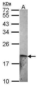 Endothelin 2 Polyclonal Antibody