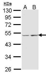 COX15 Polyclonal Antibody