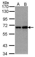 FBXW11 Antibody in Western Blot (WB)