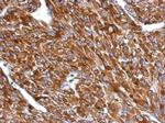 BIN1 Antibody in Immunohistochemistry (Paraffin) (IHC (P))