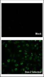 Dengue Virus Type 2 Capsid Polyclonal Antibody