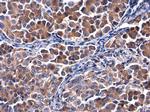 Calpastatin Polyclonal Antibody