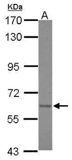 Asparagine Synthetase Polyclonal Antibody