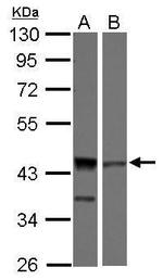 ICAD Polyclonal Antibody
