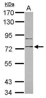 CD180 Antibody in Western Blot (WB)