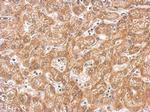 PAK1 Antibody in Immunohistochemistry (Paraffin) (IHC (P))