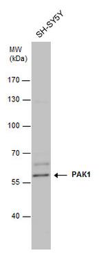 PAK1 Antibody in Western Blot (WB)