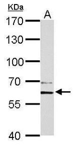 PAK1 Antibody in Western Blot (WB)