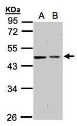 GALK2 Polyclonal Antibody