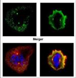 Aurora A Polyclonal Antibody