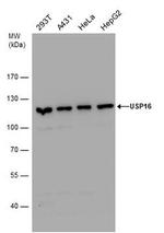 USP16 Antibody in Western Blot (WB)