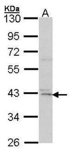 DAPK2 Antibody in Western Blot (WB)
