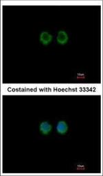 MOK Polyclonal Antibody