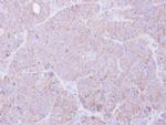 MOK Antibody in Immunohistochemistry (Paraffin) (IHC (P))