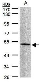 MOK Antibody in Western Blot (WB)