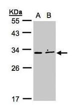 XRCC2 Polyclonal Antibody
