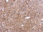 TNFAIP2 Polyclonal Antibody