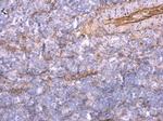 TNFAIP2 Antibody in Immunohistochemistry (Paraffin) (IHC (P))