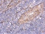 TNFAIP2 Antibody in Immunohistochemistry (Paraffin) (IHC (P))
