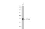 TNFAIP2 Antibody in Western Blot (WB)