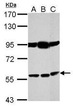 Bestrophin 1 Polyclonal Antibody