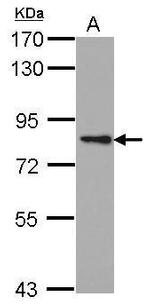 PKC epsilon Polyclonal Antibody