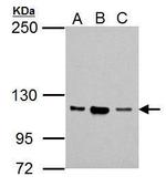 NOP2 Polyclonal Antibody