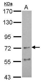 CHRNA4 Polyclonal Antibody