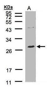 NTAL Polyclonal Antibody
