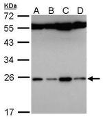 FAM9B Polyclonal Antibody