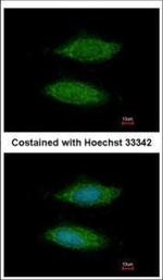 C11orf85 Polyclonal Antibody