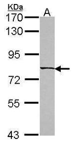 C6orf97 Antibody in Western Blot (WB)