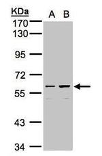 C18orf14 Polyclonal Antibody