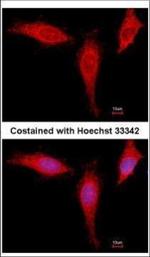 eIF4A1 Antibody in Immunocytochemistry (ICC/IF)