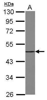 eIF4A1 Antibody in Western Blot (WB)